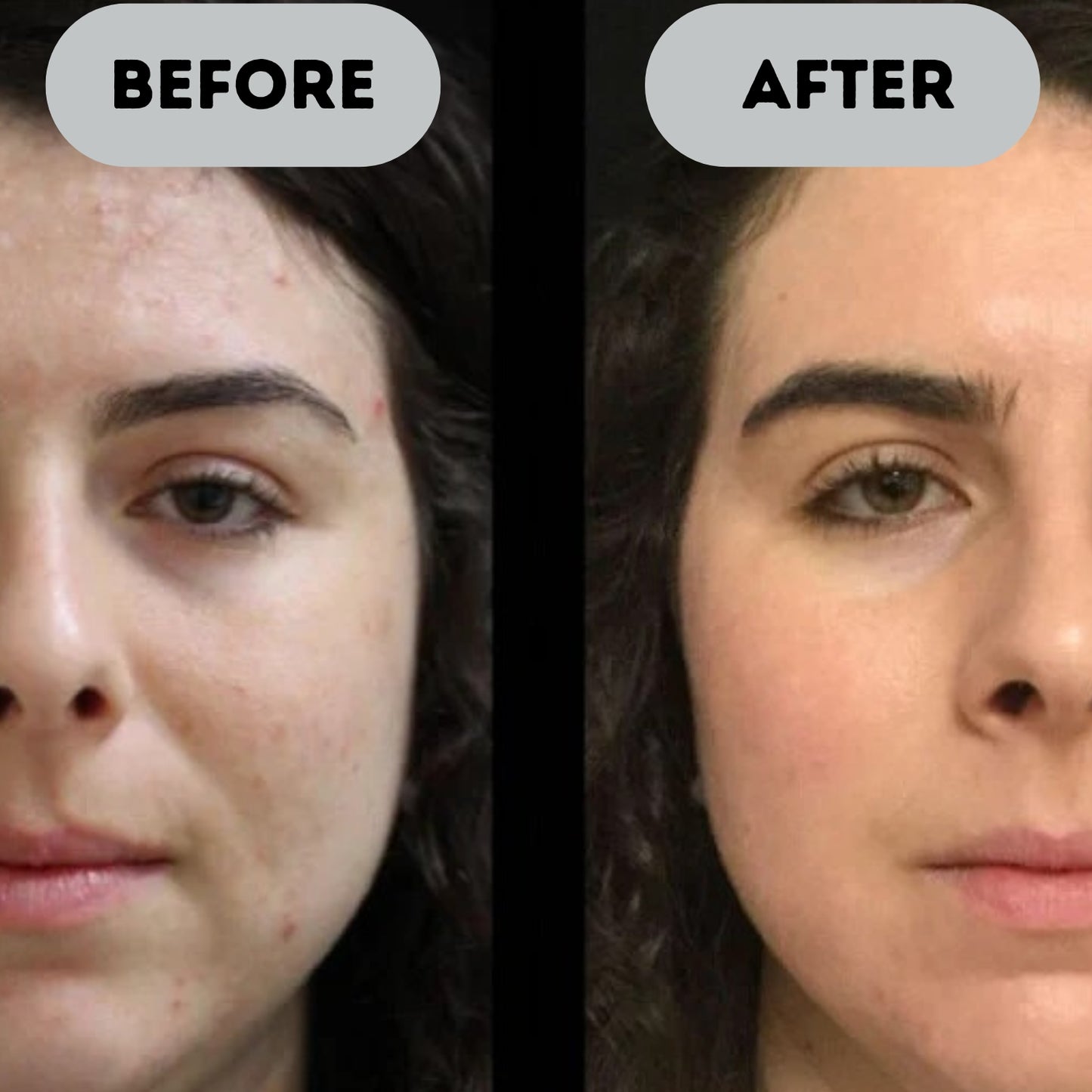 Voruva™ - Anti-Aging Booster Pro